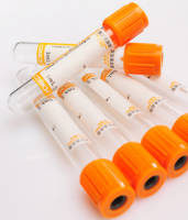 Clot Activator Tubes Evacuated Blood Collection Serum Tube, Test Tube For Blood Sample Colletion (CE) From China