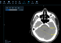 B/S PACS Imaging And Video