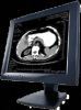 DICOM/Video CT/DR/CR/MR