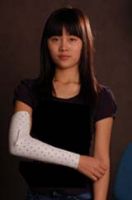Medical High Polymer Splint