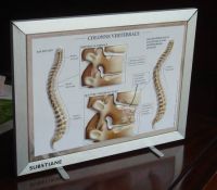 3D medical chart