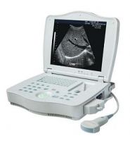 CE-Portable Ultrasound Scanner(LEO-3000E1