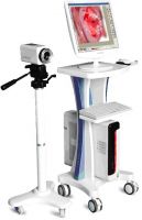 Colposcope