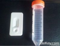 Anti-canine Rabies Virus Rapid Test