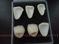 Zirconia Crown&bridge&veneer