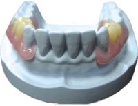 Valplast Partial
