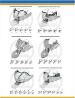 Impression Trays Perforated, Solid, Partial, Full Denture