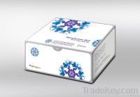 GenoQuant HCV Real-time PCR Test Kit