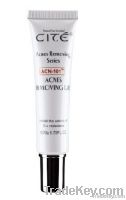 Acne removing cream