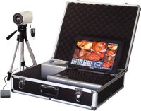 Electronic Colposcope (portable