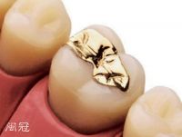casts the porcelain to inlay the body