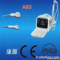 portable ultrasound system