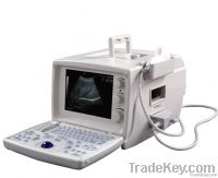 B-Mode Portable Ultrasound scanner