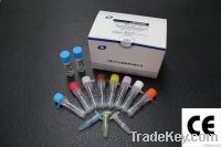 HPV 16&amp;18 Real Time PCR Kit