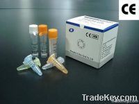 Foot-and-Mouth Disease Virus (FMDV) Real Time RT-PCR Kit