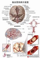 Two-sided 3D Medical Anatomical PVC Chart