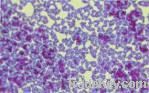 Enterococcus Faecalis - Faeciu