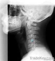 Medical image film, image film, AGFA film, dry media