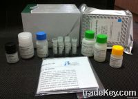 NT-proBNP ELISA Kit (human