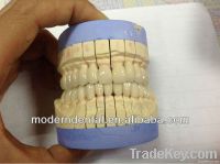 Dental all-ceramic zirkon Crown supplier