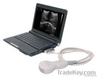 UBook-7 Ultrasound B scanner(Notebook)