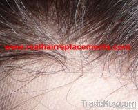 men&#039;s toupee, hair systems, hair replacements, hair pieces