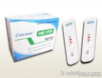 AFP Alpha-Fetoprotein Test