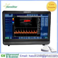 C8 Color Doppler Ultrasound System(Touch Screen)