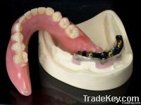 Denture (Implant Bar Overdenture)