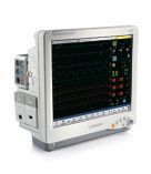 STAR5000E Fetal Monitor