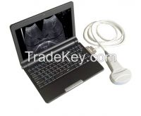 BLS&Atilde;&macr;&Acirc;&frac14;&iuml;&iquest;&frac12;810 Laptop Full Digital Ultrasound