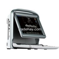 Color Doppler ECO5