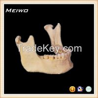 Mandible bone