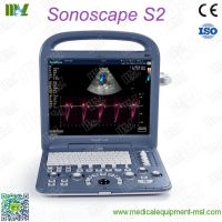 Factory direct sales ecografo sonoscape s2 price lis